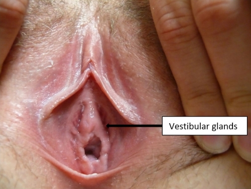 Figure F-23: Normal small sulci of lesser vestibular glands
