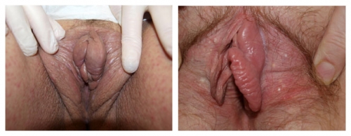 Figure F-32: Examples of edema distorting normal anatomy