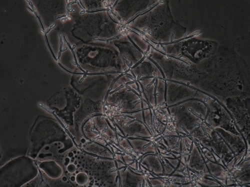 Pseudohyphae of Candida Albicans