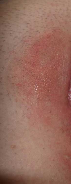dermatological-terminology-patch