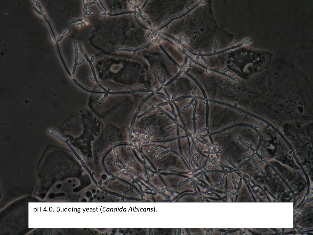 Pseudohyphae of Candida Albicans.