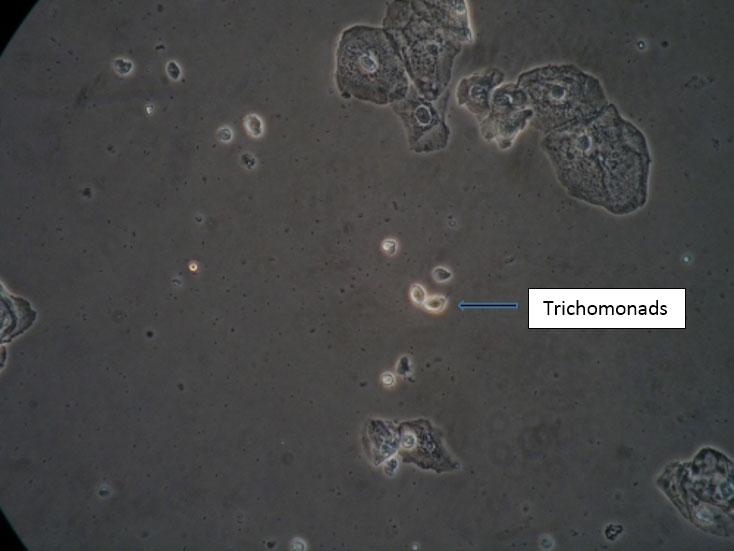 P: Vaginal Secretions, PH, Microscopy, And Cultures - Vulvovaginal ...